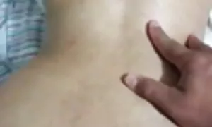 deg prolaps anal tam ...